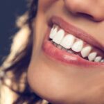 Smile Enhancement After Gum Disease