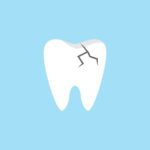 Treatment for a Tooth Fracture