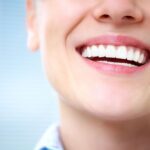 Why Whiten Teeth with Your Dentist