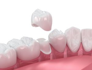 Taking the time to care for your new dental crown